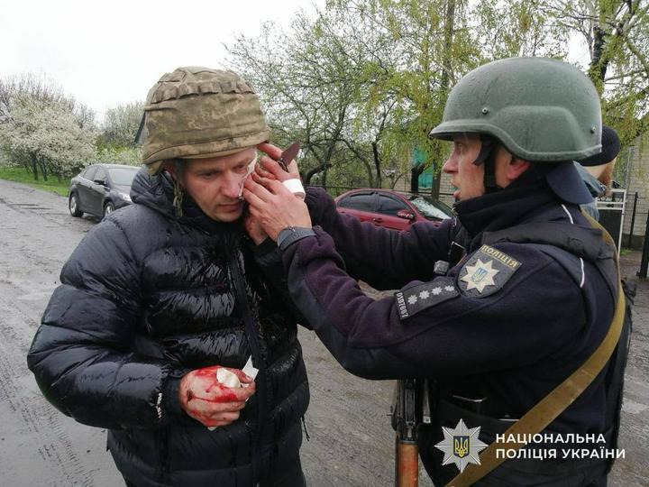 На Дніпропетровщині чоловік кинув гранату в поліцейських – є поранені (фото)