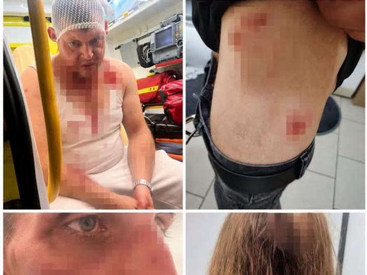 Побиття українців у Польщі: в поліції заявили, що причиною стала музика