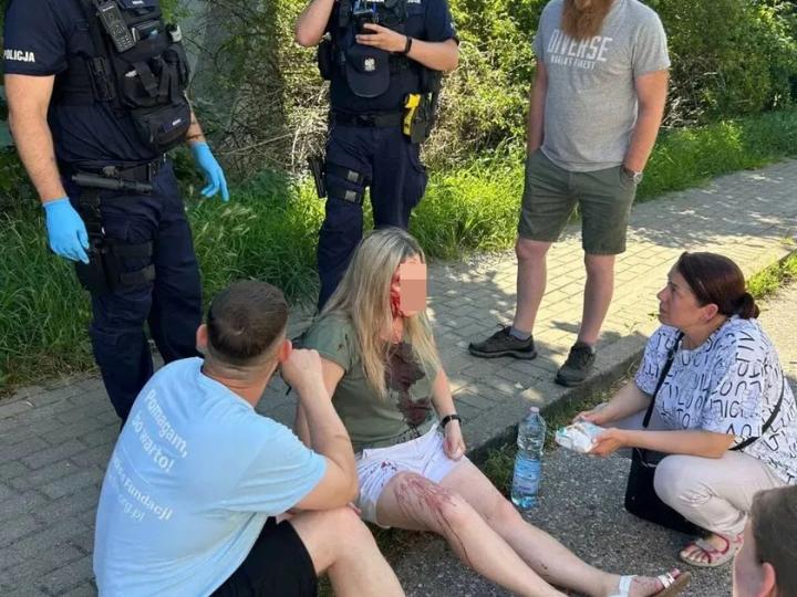 У Польщі напали на 40-річну українку: поліція розшукує нападника