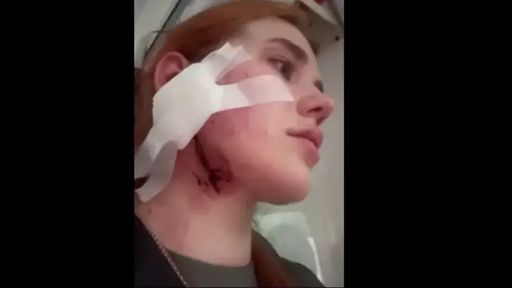 У Польщі жорстоко побили українців: українське МЗС відреагувало