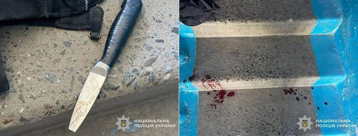 У Тернополі 15-річна школярка завдала ножових поранень іншій: дитина в реанімації