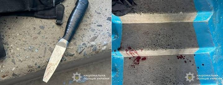 У Тернополі 15-річна школярка завдала ножових поранень іншій: дитина в реанімації